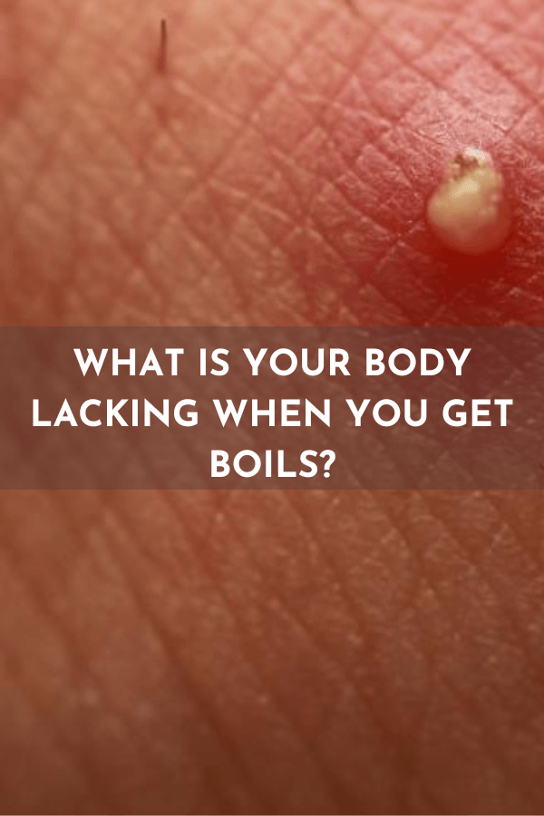 What is your body lacking when you get boils?