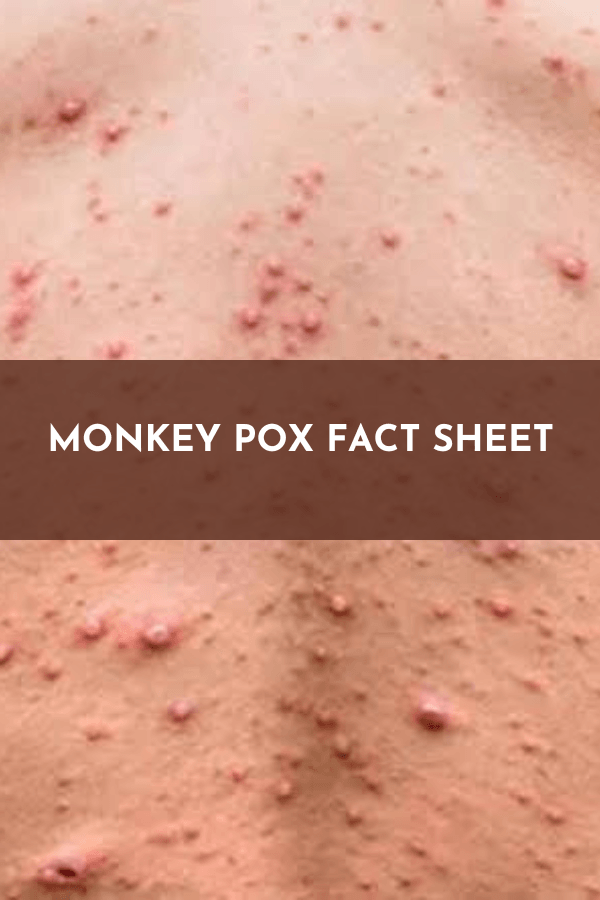 Monkey pox fact sheet