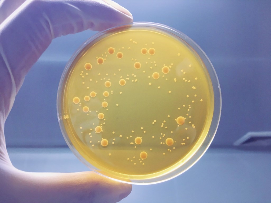 can escherichia coli grow on nutrient agar