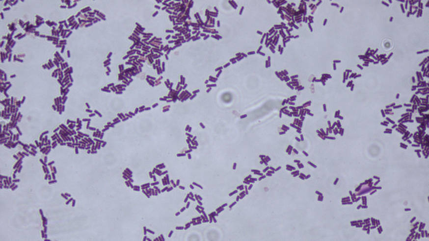 can you use the gram staining protocol on mycoplasma